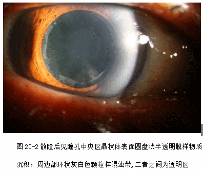 ZY016_102_3.gif